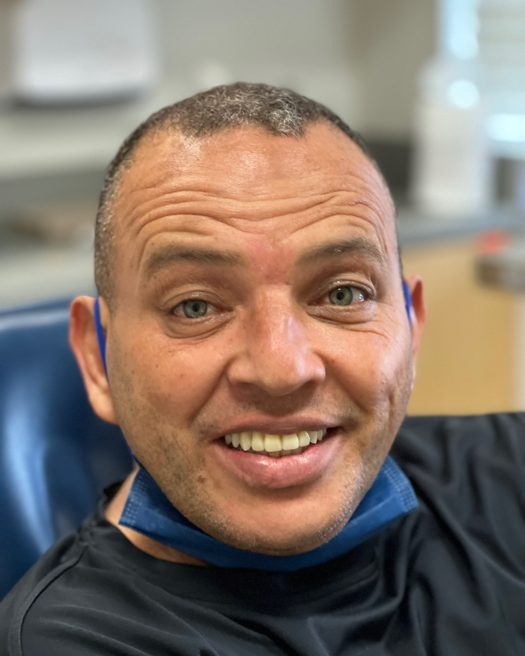 Patient smiling after treatment, photo 6
